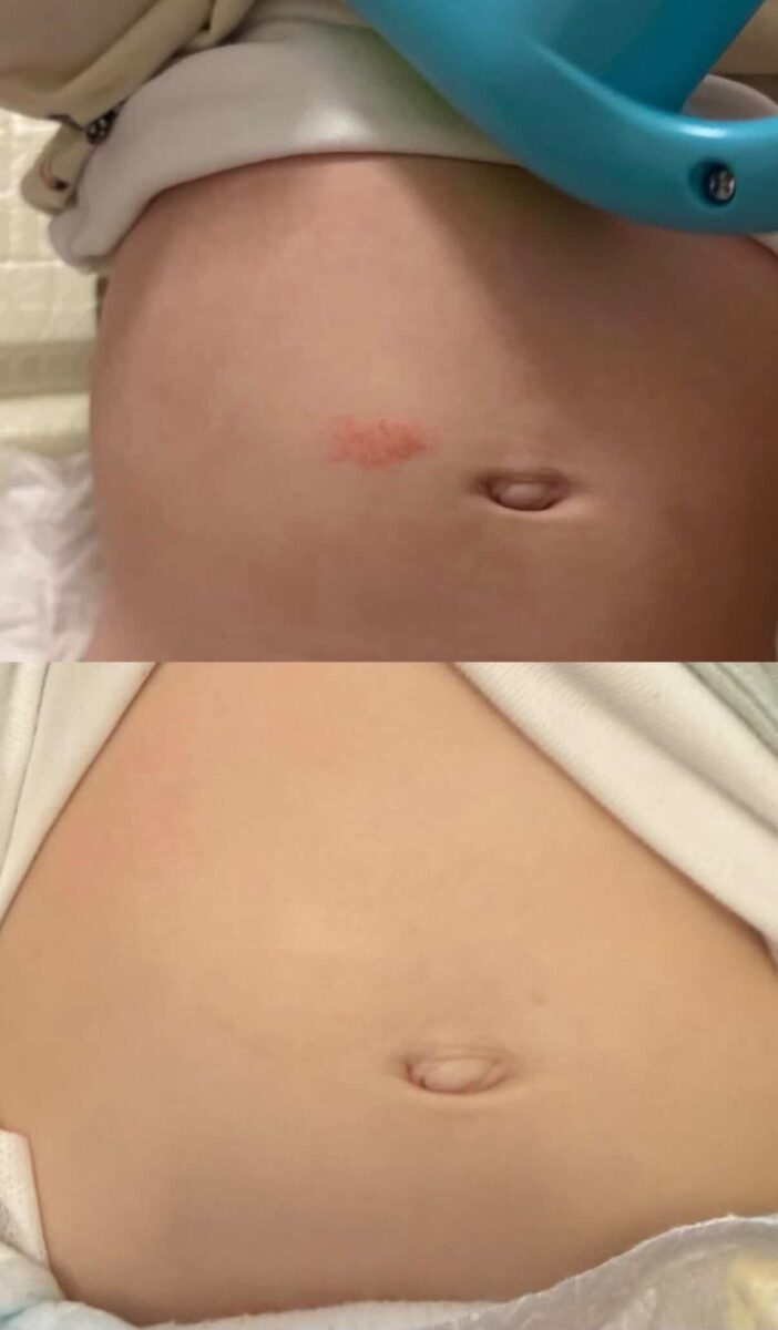 Image #1 from Martina