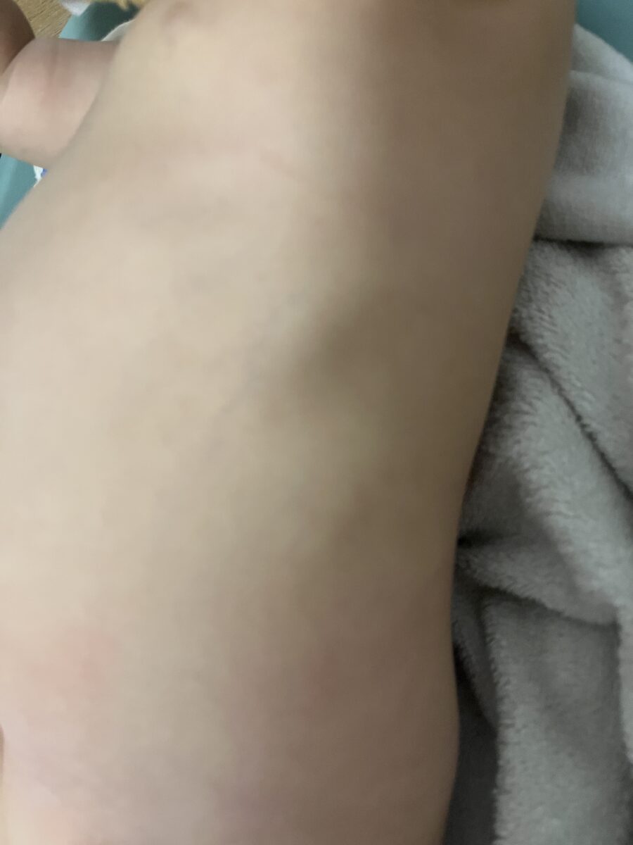 Image #2 from Ana